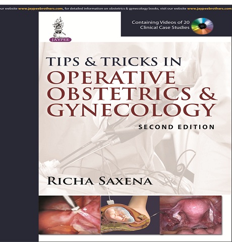 Tips and Tricks in Operative Obstetrics Gynecology, 2-Edition